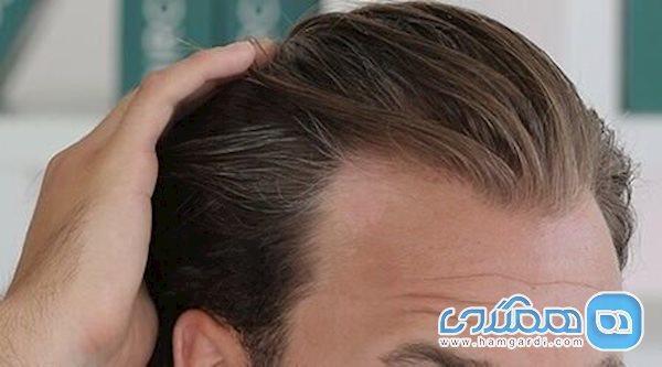 چه کنیم موهایمان سالم بماند؟ چه کنیم موهایمان سالم بماند؟