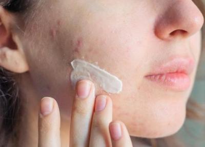برای درمان جوش صورت در پوست های خشک چه باید کرد؟
